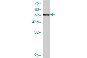 Western Blot detection against Immunogen (60.