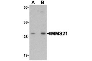 Western blot analysis of MMS21 in 293 cell lysate with MMS21 antibody at (A) 0. (NSMCE2 anticorps  (C-Term))