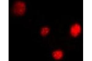 Immunofluorescent analysis of PPAR delta staining in U2OS cells.