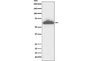 Western blot analysis of RPE65 expression in mouse eyeball lysate.
