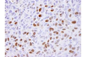 Immunohistochemistry (IHC) image for anti-Minichromosome Maintenance Complex Component 2 (MCM2) (AA 1-50) antibody (ABIN7448987) (MCM2 anticorps  (AA 1-50))