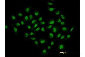 Immunofluorescence of monoclonal antibody to HDAC1 on HeLa cell. (HDAC1 anticorps  (AA 1-482))