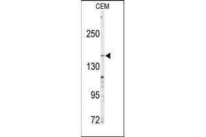 Western blot analysis of anti-ABCC4 Antibody (C-term) in CEM cell line lysates (35ug/lane). (ABCC4 anticorps  (C-Term))