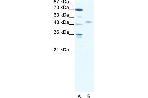 WB Suggested Anti-IRF5 Antibody Titration:  2. (IRF5 anticorps  (N-Term))