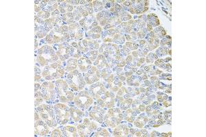 Immunohistochemistry of paraffin-embedded mouse stomach using SKAP2 antibody (ABIN5973835) at dilution of 1/100 (40x lens).