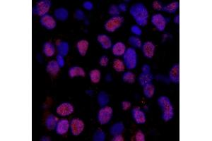 anti-X-Ray Repair Complementing Defective Repair in Chinese Hamster Cells 1 (XRCC1) (pSer518), (pThr519), (pThr523) antibody