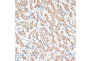 Immunohistochemistry of paraffin-embedded human liver using PON1 Rabbit mAb (ABIN7269172) at dilution of 1:100 (40x lens).