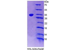 SDS-PAGE (SDS) image for Protein tyrosine Phosphatase, Non-Receptor Type 2 (PTPN2) (AA 1-237) protein (His tag) (ABIN4989862) (PTPN2 Protein (AA 1-237) (His tag))