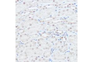 Immunohistochemistry of paraffin-embedded mouse kidney using NEDD9 Rabbit pAb (ABIN3023330, ABIN3023331, ABIN3023332 and ABIN6219606) at dilution of 1:100 (40x lens).