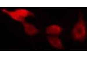 ABIN6266493 staining HeLa cells by IF/ICC. (RAD17 anticorps  (C-Term))