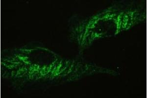 IF/ICC testing of human A549 cells with Ataxin-2 antibody at 2ug/ml. (Ataxin 2 anticorps  (C-Term))