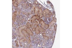Immunohistochemical staining (Formalin-fixed paraffin-embedded sections) of human kidney with SAV1 polyclonal antibody  shows strong cytoplasmic positivity in renal tubules. (SAV1 anticorps)