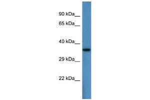 Host:  Rabbit  Target Name:  Pard6b  Sample Type:  Mouse Heart lysates  Antibody Dilution:  1. (PARD6B anticorps  (N-Term))