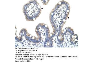 Human Intestine (NFKBIB anticorps  (C-Term))