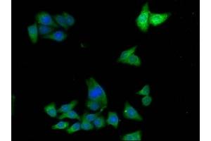 Immunofluorescence staining of HepG2 cells with ABIN7143652 at 1:133,counter-stained with DAPI. (ADH7 anticorps  (AA 1-386))