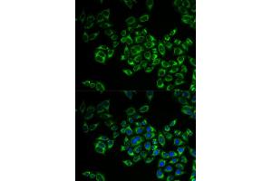 Immunofluorescence analysis of MCF-7 cell using FIS1 antibody. (Fission 1 anticorps)