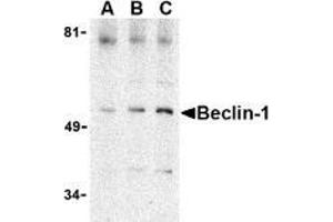 AP20057PU-N Beclin-1 antibody staining of A431 cell lysate by Western Blotting at (A) 0. (Beclin 1 anticorps  (C-Term))