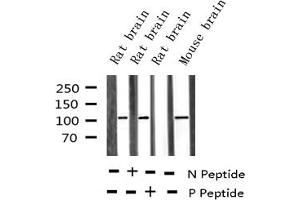 Western blot analysis of Phospho-Retinoblastoma (Ser795) expression in various lysates