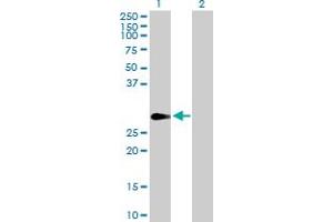 Western Blot analysis of FHL1 expression in transfected 293T cell line by FHL1 MaxPab polyclonal antibody.