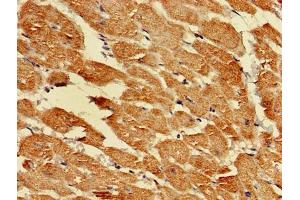 Immunohistochemistry of paraffin-embedded human heart tissue using ABIN7164407 at dilution of 1:100