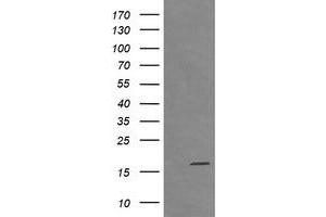Image no. 1 for anti-Cancer/testis Antigen 1B (CTAG1B) antibody (ABIN1499889) (CTAG1B anticorps)