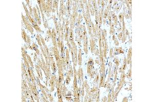 IHC analysis of SPAG7 using anti-SPAG7 antibody (ABIN7599072). (SPAG7 anticorps  (AA 1-199))