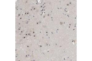Immunohistochemical staining of human hippocampus with NOL11 polyclonal antibody  shows strong nucleolar positivity in neuronal cells at 1:20-1:50 dilution. (NOL11 anticorps)