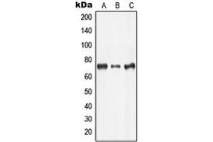 Western blot analysis of LIMK2 expression in Jurkat (A), COLO205 (B), MCF7 (C) whole cell lysates. (LIMK2 anticorps  (Center))