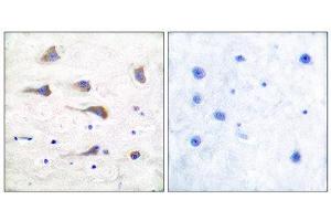 Immunohistochemistry (IHC) image for anti-Glutamate Receptor, Metabotropic 6 (GRM6) (C-Term) antibody (ABIN1848576)