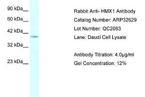 WB Suggested Anti-HMX1 AntibodyTitration: 4. (HMX1 anticorps  (Middle Region))