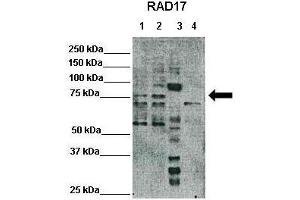 WB Suggested Anti-RAD17 Antibody  Positive Control: Lane1: 25ug Hela lysate, Lane2: 25ug HEK293T lysate, Lane3: 25ug Xenopus laevis egg extract, Lane4: 25ug mouse embryonic stem cells lysate Primary Antibody Dilution :  1:500 Secondary Antibody :  Anti-rabbit-HRP  Secondry Antibody Dilution :  1:3000 Submitted by: Domenico Maiorano, Institute of Human Genetics, CNRS (RAD17 anticorps  (C-Term))
