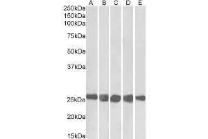 ABIN5539634 (0. (CSNK2B anticorps  (AA 172-186))