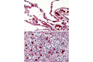 Immunohistochemistry (Formalin/PFA-fixed paraffin-embedded sections) of human lung (A) and human spleen, red pulp (B) tissue with GPR132 polyclonal antibody . (G Protein-Coupled Receptor 132 anticorps  (Cytoplasmic Domain))
