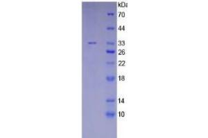 SDS-PAGE of Protein Standard from the Kit (Highly purified E. (MGEA5 Kit ELISA)