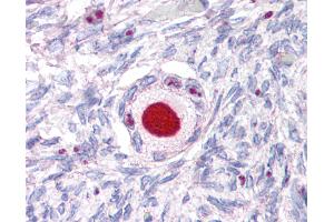 Anti-NR5A1 antibody IHC of human ovary.