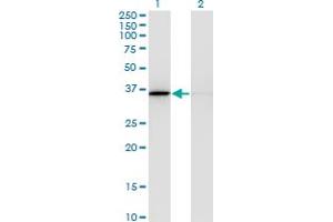 Western Blot analysis of MDH1 expression in transfected 293T cell line by MDH1 monoclonal antibody (M03), clone 1D2. (MDH1 anticorps  (AA 101-193))