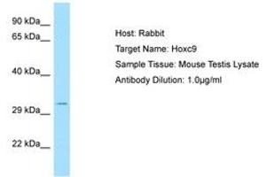Image no. 1 for anti-Homeobox C9 (HOXC9) (C-Term) antibody (ABIN6749849)