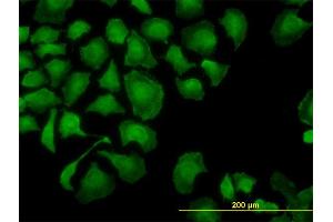 Immunofluorescence of monoclonal antibody to TROVE2 on HeLa cell.