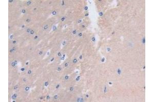Detection of MYL3 in Mouse Cerebrum Tissue using Polyclonal Antibody to Myosin Light Chain 3, Alkali, Ventricular, Slow Skeletal (MYL3) (MYL3/CMLC1 anticorps  (AA 8-199))