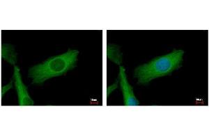 ICC/IF Image NDUFS2 antibody detects NDUFS2 protein at mitochondria by immunofluorescent analysis. (NDUFS2 anticorps  (Center))