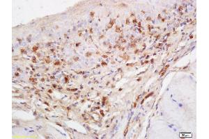Formalin-fixed and paraffin embedded rat tongue labeled with Anti-RASA3 Polyclonal Antibody, Unconjugated (ABIN760316) at 1:200 followed by conjugation to the secondary antibody and DAB staining