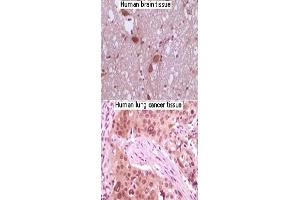 Immunohistochemical analysis of paraffin-embedded human brain tissue and lung carcinoma tissue, showing nuclear/cytoplasmic localization using MAPK10 monoclonal antibody, clone 8A5D11  with DAB staining. (MAPK10 anticorps)
