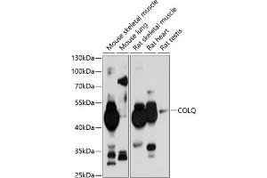 Western blot analysis of extracts of various cell lines, using COLQ antibody (ABIN6131427, ABIN6138859, ABIN6138860 and ABIN6214704) at 1:1000 dilution. (COLQ anticorps  (AA 276-455))