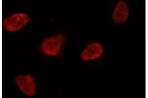 ABIN6269396 staining Hela by IF/ICC.