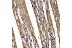 Immunohistochemistry of paraffin-embedded rat heart using PTPN2 antibody at dilution of 1:100 (400x lens). (PTPN2 anticorps)