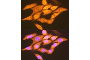 Immunofluorescence analysis of NIH-3T3 cells using FGF1 Rabbit mAb (ABIN7267182) at dilution of 1:100 (40x lens).