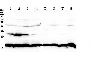 Western blot analysis of Cyclophilin B using anti-Cyclophilin B antibody . (PPIB anticorps  (AA 158-216))