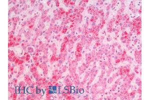 ABIN2613452 (5µg/ml) staining of paraffin embedded Human Liver.