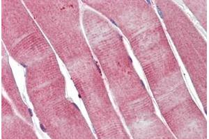 Human Skeletal Muscle: Formalin-Fixed, Paraffin-Embedded (FFPE) (PGAM2 anticorps)