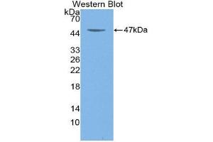 Western Blotting (WB) image for anti-Colony Stimulating Factor 2 (Granulocyte-Macrophage) (CSF2) (AA 18-144) antibody (ABIN1868194) (GM-CSF anticorps  (AA 18-144))